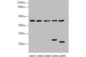 Western blot All lanes: LHX6 antibody at 3. (LHX6 Antikörper  (AA 114-363))