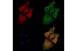 ABIN7094050 and ABIN7098094 staining Hela cells by IF/ICC.