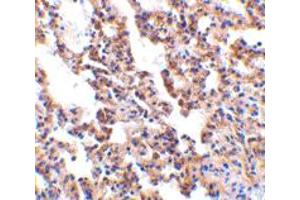 Immunohistochemistry of IL21R in rat lung with IL21R polyclonal antibody  at 10 ug/mL . (IL21 Receptor Antikörper  (AA 97-111))