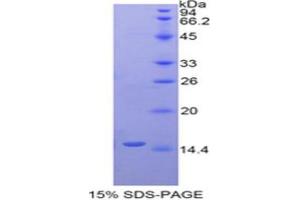 SDS-PAGE analysis of Human LYAR Protein. (LYAR Protein)