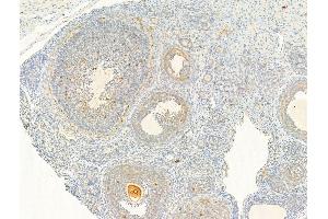 ABIN6255661 and ABIN6267025 at 1/100 staining Rat ovary tissue by IHC-P. (AKT1 Antikörper  (pThr308))