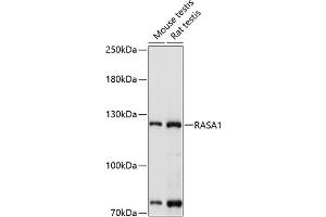 Western blot analysis of extracts of various cell lines, using R antibody (ABIN3022296, ABIN3022297, ABIN3022298 and ABIN6218715) at 1:1000 dilution. (RASA1 Antikörper  (AA 140-220))