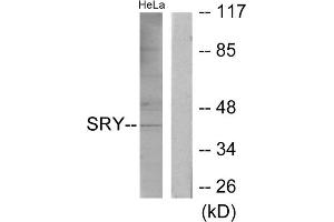 Western blot analysis of extracts from HeLa cells, using SRY antibody. (SRY Antikörper  (Internal Region))