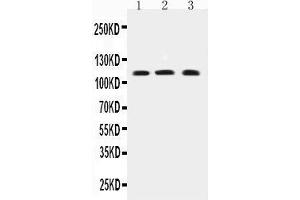Western Blotting (WB) image for anti-Transient Receptor Potential Cation Channel, Subfamily C, Member 4 (TRPC4) (AA 961-977), (C-Term) antibody (ABIN3042531) (TRPC4 Antikörper  (C-Term))