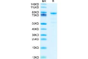 Mouse DSG-2/Desmoglein-2 on Tris-Bis PAGE under reduced condition. (Desmoglein 2 Protein (DSG2) (AA 55-618) (His tag))