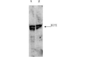 Western blot using  affinity purified anti-ECT2 pT790 antibody shows detection of endogenous phosphorylated ECT2 (arrowhead) present in cell lysates from interphase (lane 1) and mitotic (lane 2) HeLa cells. (ECT2 Antikörper  (pThr790))