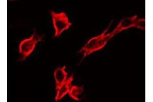 Immunofluorescence (fixed cells) (IF/ICC) image for anti-Insulin-Like Growth Factor 1 Receptor (IGF1R) (pTyr1346) antibody (ABIN6256637)