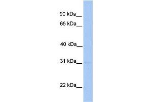 WB Suggested Anti-MMD2 Antibody Titration: 0.