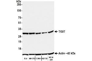 Western Blotting (WB) image for anti-T Cell Immunoreceptor with Ig and ITIM Domains (TIGIT) (AA 26-143) antibody (ABIN7449161)