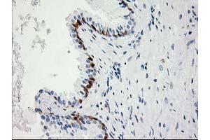 Image no. 6 for anti-Hydroxyprostaglandin Dehydrogenase 15-(NAD) (HPGD) antibody (ABIN1496363) (HPGD Antikörper)