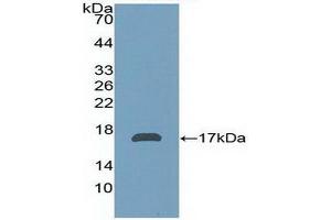 Western blot analysis of recombinant Human aZGP1. (AZGP1 Antikörper  (AA 180-298))