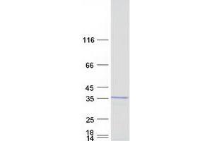 Western Blotting (WB) image for BCDIN3 Domain Containing (BCDIN3D) protein (Myc-DYKDDDDK Tag) (ABIN2715187)