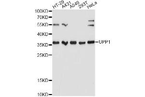 Western blot analysis of extracts of various cell lines, using UPP1 Antibody. (UPP1 Antikörper)