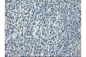 Image no. 1 for anti-Crystallin, alpha B (CRYAB) antibody (ABIN1497645) (CRYAB Antikörper)