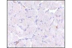 Immunohistochemistry of LIMP2 in human skeletal muscle tissue with this product at 10 μg/ml. (SCARB2 Antikörper  (C-Term))