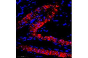 Immunofluorescence (Paraffin-embedded Sections) (IF (p)) image for anti-Centrosomal Protein 78kDa (CEP78) antibody (ABIN7073432)