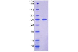 SDS-PAGE analysis of Mouse NCR1 Protein. (NCR1 Protein)