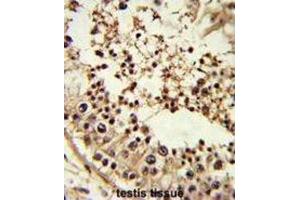 Immunohistochemistry (IHC) image for anti-TATA Box Binding Protein (TBP) antibody (ABIN3002745) (TBP Antikörper)