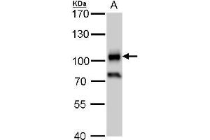 WB Image CD19 antibody detects CD19 protein by western blot analysis.