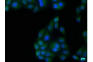 Immunofluorescence staining of Hela cells with ABIN7140130 at 1:133, counter-stained with DAPI. (TBK1 Antikörper  (AA 644-661))