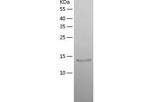 Western Blotting (WB) image for Dual Specificity Phosphatase 23 (DUSP23) (AA 1-150) protein (His tag) (ABIN7122712) (DUSP23 Protein (AA 1-150) (His tag))