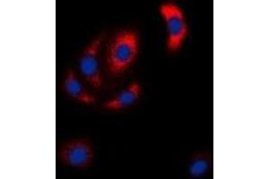 Immunofluorescent analysis of MKK6 staining in Hela cells. (MAP2K6 Antikörper  (N-Term))