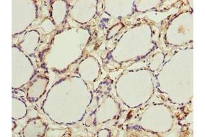 Immunohistochemistry of paraffin-embedded human thyroid tissue using ABIN7166396 at dilution of 1:100 (PADI3 Antikörper  (AA 1-664))