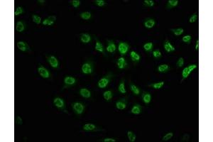 Immunofluorescence staining of Hela cells with ABIN7127715 at 1:100,counter-stained with DAPI. (Rekombinanter MTOR Antikörper  (pSer2481))