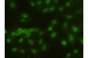 Immunofluorescent staining of HeLa cells using anti-HHex mouse monoclonal antibody (ABIN2452382). (HHEX Antikörper  (AA 100-270))