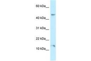 Image no. 1 for anti-Pleckstrin Homology Domain Containing, Family J Member 1 (PLEKHJ1) (AA 86-135) antibody (ABIN6747910) (GNRPX Antikörper  (AA 86-135))
