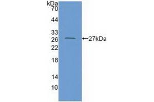 Coxsackie Adenovirus Receptor Antikörper  (AA 20-229)