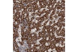 Immunohistochemical staining of human liver with ROGDI polyclonal antibody  shows strong cytoplasmic positivity in hepatocytes. (ROGDI Antikörper)