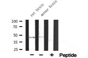 Western blot analysis of extracts of various tissue ,using ACAT1 antibody. (ACAT1 Antikörper  (Internal Region))