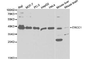 Western blot analysis of extracts of various cell lines, using ERCC1 antibody (ABIN5973037) at 1/1000 dilution. (ERCC1 Antikörper)