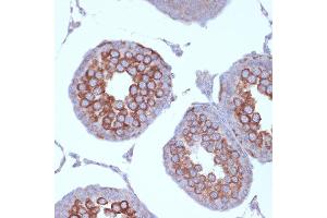 Immunohistochemistry of paraffin-embedded rat testis using KIF3A Rabbit mAb (ABIN7268132) at dilution of 1:100 (40x lens). (KIF3A Antikörper)