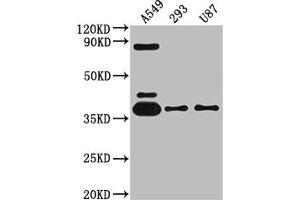 Western Blot Positive WB detected in: A549 whole cell lysate, 293 whole cell lysate, U87 whole cell lysate All lanes: ADORA1 antibody at 1:2000 Secondary Goat polyclonal to rabbit IgG at 1/50000 dilution Predicted band size: 37, 14 kDa Observed band size: 37 kDa (Rekombinanter ADORA1 Antikörper)