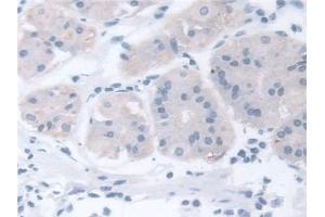 Immunohistochemistry (IHC) image for anti-Chaperonin Containing TCP1, Subunit 2 (Beta) (CCT2) (AA 1-488) antibody (ABIN7441646)