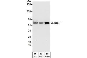 Western Blotting (WB) image for anti-Ubiquitin Protein Ligase E3 Component N-Recognin 7 (UBR7) (AA 1-50) antibody (ABIN7450870)