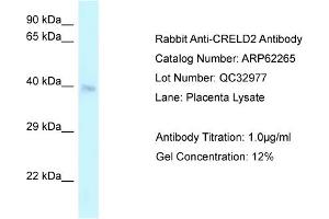 Western Blotting (WB) image for anti-Cysteine-Rich with EGF-Like Domains 2 (CRELD2) (C-Term) antibody (ABIN2789088) (CRELD2 Antikörper  (C-Term))