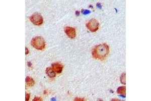 Immunohistochemical analysis of CDK6 staining in human brain formalin fixed paraffin embedded tissue section. (CDK6 Antikörper)
