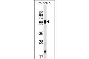 Western blot analysis in mouse brain tissue lysates (35ug/lane).