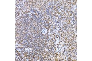Immunohistochemistry of paraffin-embedded rat spleen using Snail Rabbit pAb (ABIN1682836, ABIN3019402, ABIN3019403, ABIN3019404 and ABIN6220883) at dilution of 1:150 (40x lens). (SNAIL Antikörper  (AA 1-100))