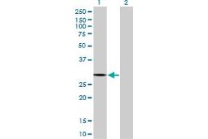 Western Blot analysis of PACRG expression in transfected 293T cell line by PACRG MaxPab polyclonal antibody.