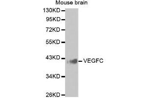 Western Blotting (WB) image for anti-Vascular Endothelial Growth Factor C (VEGFC) antibody (ABIN6219656) (VEGFC Antikörper)
