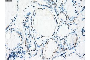 Immunohistochemical staining of paraffin-embedded Ovary tissue using anti-CRYABmouse monoclonal antibody. (CRYAB Antikörper)