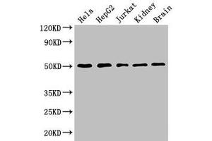 Western Blot Positive WB detected in: Hela whole cell lysate, HepG2 whole cell lysate, Jurkat whole cell lysate, Mouse kidney tissue, Mouse brain tissue All lanes: TUBA3C antibody at 3 μg/mL Secondary Goat polyclonal to rabbit IgG at 1/50000 dilution Predicted band size: 50, 47 kDa Observed band size: 50 kDa (TUBA3C Antikörper  (AA 161-418))