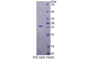 SDS-PAGE (SDS) image for Retinol Binding Protein 5, Cellular (RBP5) (AA 19-201) protein (His tag) (ABIN1080667) (Retinol Binding Protein 5 Protein (AA 19-201) (His tag))