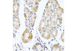 Immunohistochemistry of paraffin-embedded human stomach using MRPL11 antibody. (MRPL11 Antikörper  (AA 1-192))