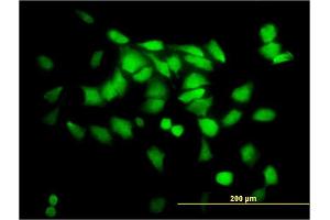 Immunofluorescence of monoclonal antibody to SGTA on HeLa cell. (SGTA Antikörper  (AA 42-123))