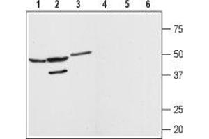 Western blot analysis of rat brain (lanes 1 and 4) kidney (lanes 2 and 5) and heart (lanes 3 and 6) membranes: - 1-3. (MAS1 Antikörper  (AA 212-224))